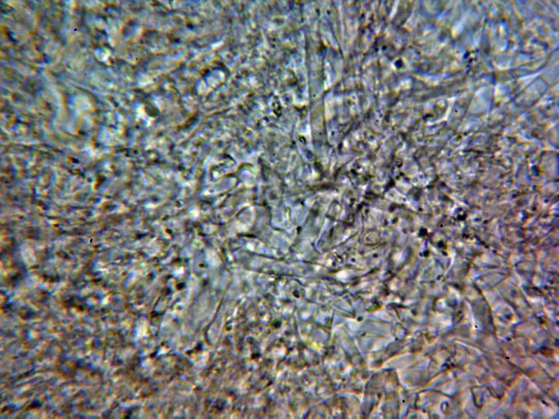 Athelia salicum 10 - Subhimenio